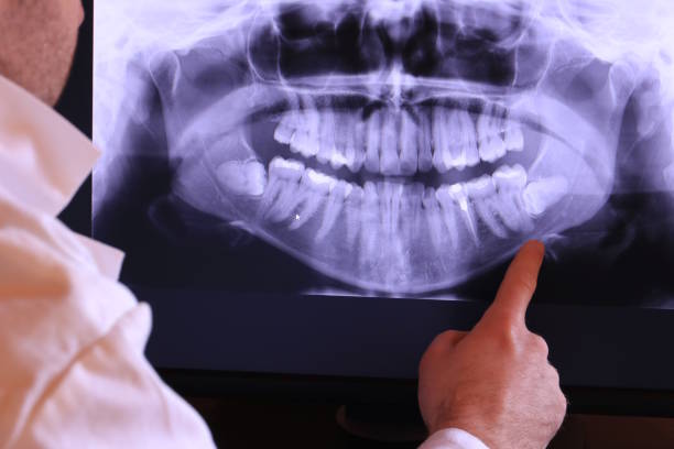 Best Knocked-Out Tooth Emergency  in Bridgetown, MS
